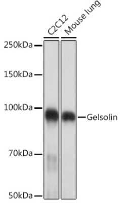 Western Blot: Gelsolin/GSN Antibody (5O10O1) [NBP3-16138]