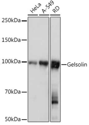 Western Blot: Gelsolin/GSN Antibody (5O10O1) [NBP3-16138]