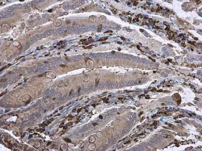 Immunohistochemistry-Paraffin: Gelsolin/GSN Antibody (GT1656) [NBP3-13559]