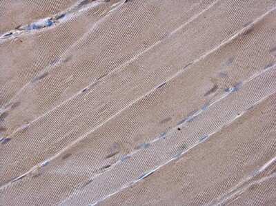 Immunohistochemistry-Paraffin: Gelsolin/GSN Antibody (GT1656) [NBP3-13559]