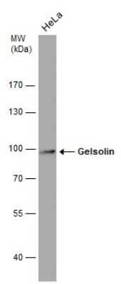 Western Blot: Gelsolin/GSN Antibody (GT1656) [NBP3-13559]