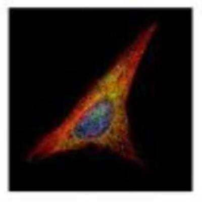 Immunocytochemistry/ Immunofluorescence: Gelsolin/GSN Antibody [NBP1-33177]