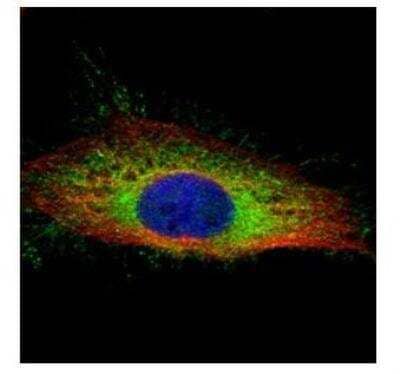 Immunocytochemistry/ Immunofluorescence: Gelsolin/GSN Antibody [NBP1-33604]