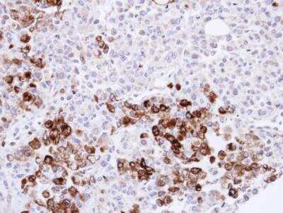 Immunohistochemistry-Paraffin: Gelsolin/GSN Antibody [NBP1-33177]