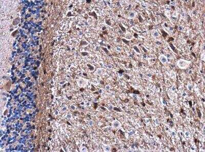 Immunohistochemistry-Paraffin: Gelsolin/GSN Antibody [NBP1-33604]