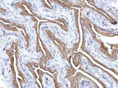 Immunohistochemistry-Paraffin: Gelsolin/GSN Antibody [NBP1-33604]