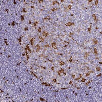 Immunohistochemistry-Paraffin: Gelsolin/GSN Antibody [NBP2-55565]