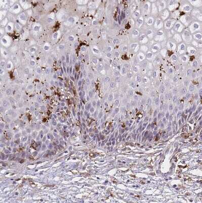 Immunohistochemistry-Paraffin: Gelsolin/GSN Antibody [NBP2-55565]