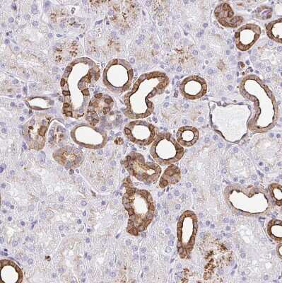 Immunohistochemistry-Paraffin: Gelsolin/GSN Antibody [NBP2-55565]