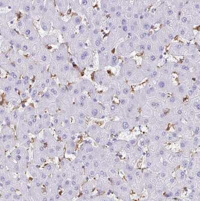 Immunohistochemistry-Paraffin: Gelsolin/GSN Antibody [NBP2-55565]