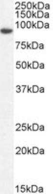 Western Blot: Gelsolin/GSN Antibody [NB100-53814]