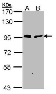 Western Blot: Gelsolin/GSN Antibody [NBP1-33177]