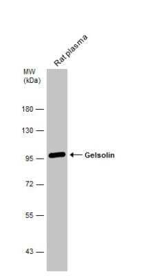 Western Blot: Gelsolin/GSN Antibody [NBP1-33177]