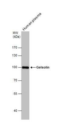 Western Blot: Gelsolin/GSN Antibody [NBP1-33177]