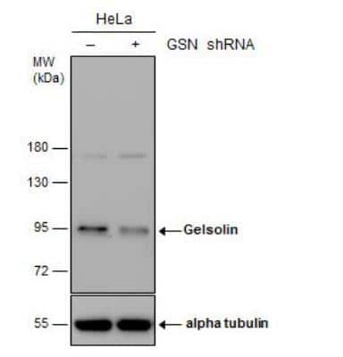 Western Blot: Gelsolin/GSN Antibody [NBP1-33177]