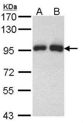 Western Blot: Gelsolin/GSN Antibody [NBP1-33604]