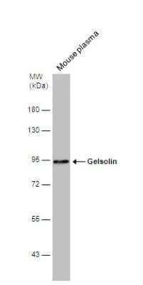 Western Blot: Gelsolin/GSN Antibody [NBP1-33604]