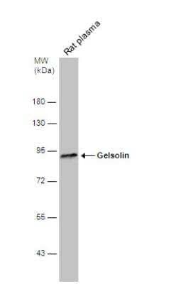 Western Blot: Gelsolin/GSN Antibody [NBP1-33604]