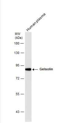 Western Blot: Gelsolin/GSN Antibody [NBP1-33604]