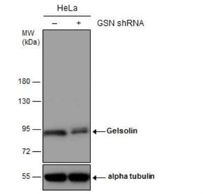 Western Blot: Gelsolin/GSN Antibody [NBP1-33604]