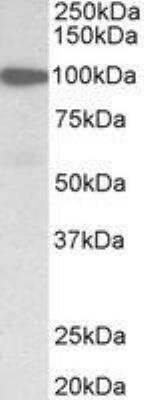 Western Blot: Gelsolin/GSN Antibody [NBP2-27566]