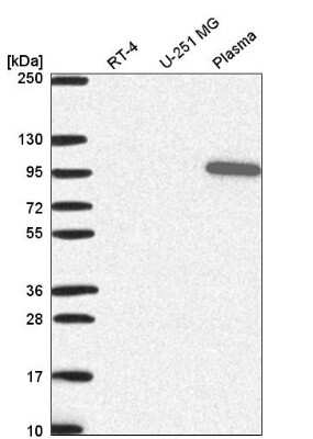 Western Blot: Gelsolin/GSN Antibody [NBP2-55565]