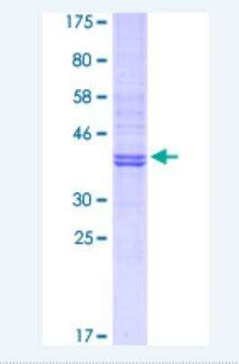 SDS-PAGE: Recombinant Human Gelsolin/GSN GST (N-Term) Protein [H00002934-Q01]