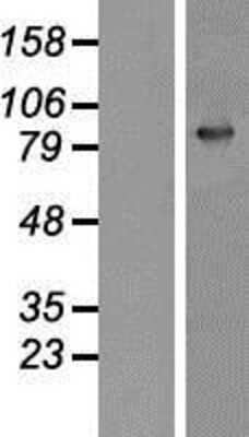 Western Blot: Gelsolin/GSN Overexpression Lysate [NBP2-11156]