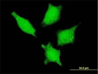 Immunocytochemistry/ Immunofluorescence: Gemin 3 Antibody (5H5) [H00011218-M01]