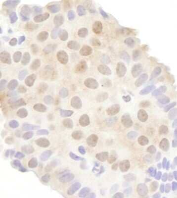 Immunohistochemistry: Gemin 3 Antibody [NB100-1801]