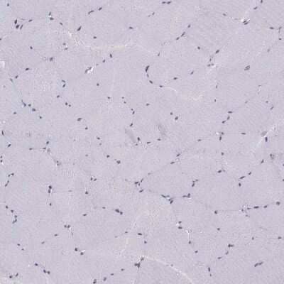 Immunohistochemistry-Paraffin: Gemin 3 Antibody [NBP1-84058]