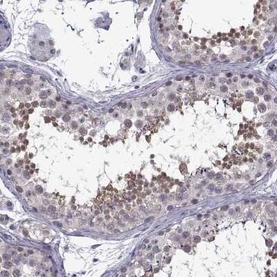 Immunohistochemistry-Paraffin: Gemin 3 Antibody [NBP1-84058]