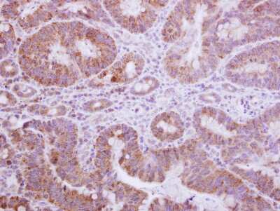 Immunohistochemistry-Paraffin: Gemin 3 Antibody [NBP2-16638]