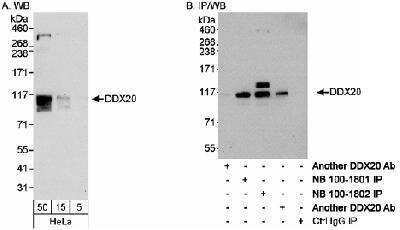 Western Blot: Gemin 3 Antibody [NB100-1802]