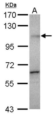 Western Blot: Gemin 3 Antibody [NBP2-16638]