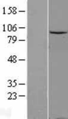 Western Blot: Gemin 3 Overexpression Lysate [NBL1-09786]