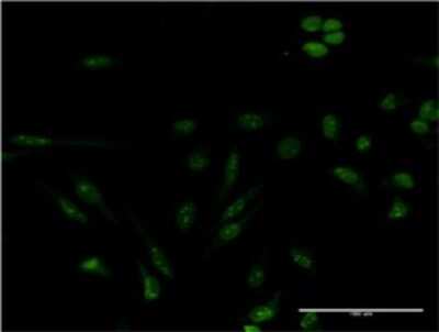 Immunocytochemistry/ Immunofluorescence: Gemin 4 Antibody (3E1) [H00050628-M01]