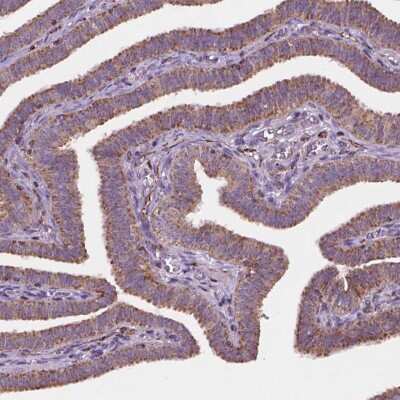 Immunohistochemistry-Paraffin: Gemin 4 Antibody [NBP2-49534]