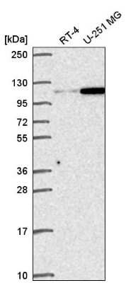 Western Blot: Gemin 4 Antibody [NBP2-55998]