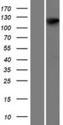 Western Blot: Gemin 4 Overexpression Lysate [NBP2-07121]