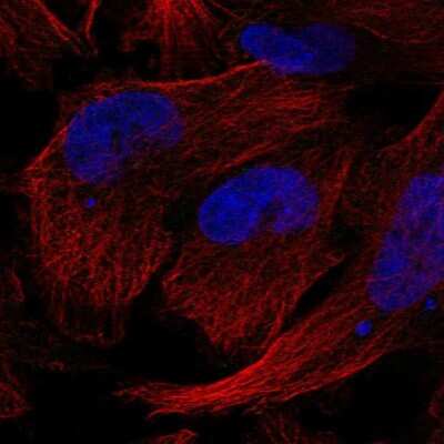 Immunocytochemistry/ Immunofluorescence: Gemin 5 Antibody [NBP2-58136]