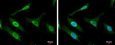 Immunocytochemistry/ Immunofluorescence: Gemin 5 Antibody [NBP3-12933]