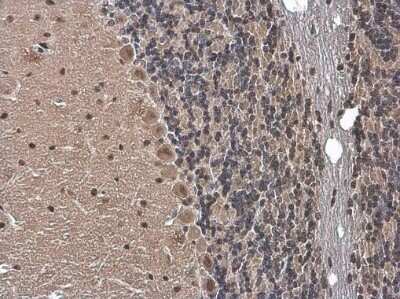 Immunohistochemistry-Paraffin: Gemin 5 Antibody [NBP3-12933]