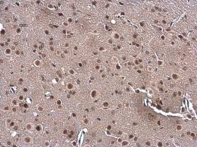 Immunohistochemistry-Paraffin: Gemin 5 Antibody [NBP3-12933]