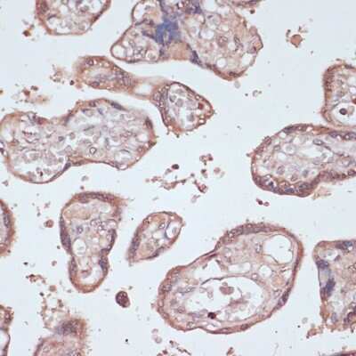 Immunohistochemistry-Paraffin: Gemin 5 Antibody - Azide and BSA Free [NBP3-15523]