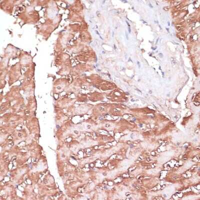 Immunohistochemistry-Paraffin: Gemin 5 Antibody - Azide and BSA Free [NBP3-15523]