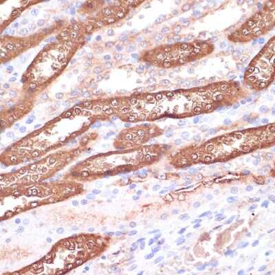 Immunohistochemistry-Paraffin: Gemin 5 Antibody - Azide and BSA Free [NBP3-15523]