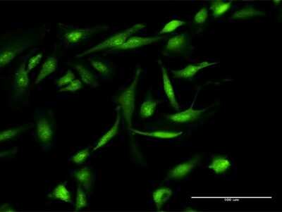 Immunocytochemistry/ Immunofluorescence: Gemin 7 Antibody [H00079760-D01P]