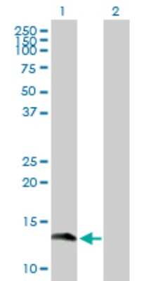 Western Blot: Gemin 7 Antibody [H00079760-D01P]