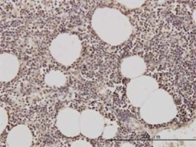 Immunohistochemistry-Paraffin: Geminin Antibody (1A8) [H00051053-M01]